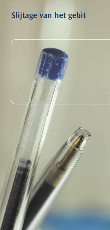 Slijtage van gebit